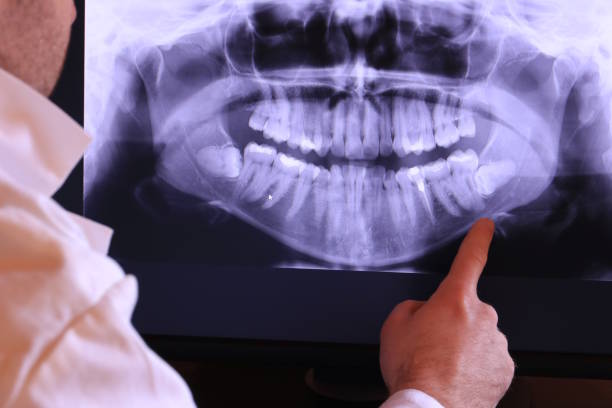 Best Emergency Treatment for Oral Infections in Oak Lawn, IL